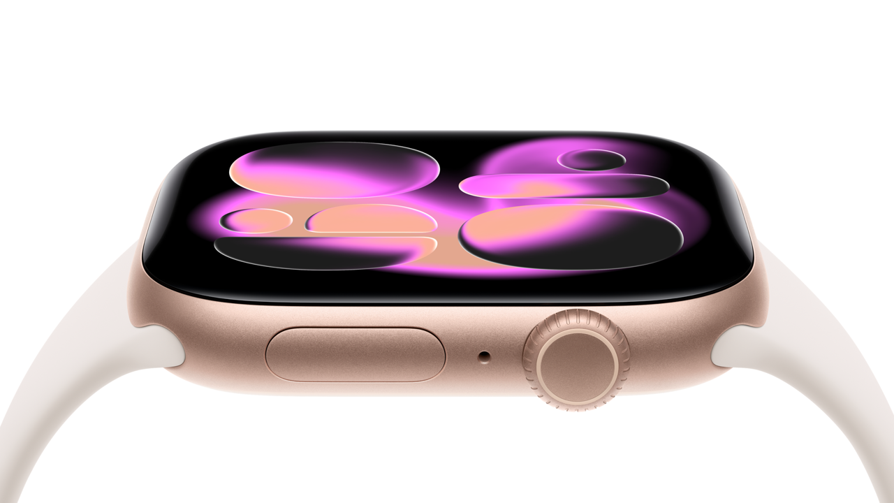 Apple-Watch-Series-11.png
