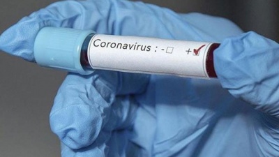 Κύπρος: Στους 8 αυξήθηκαν οι θάνατοι από κορωνοϊό, στα 550 τα κρούσματα