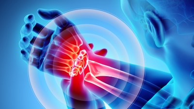 Η συχνή αιτία πόνου στον καρπό που χρειάζεται να ελεγχθεί από ειδικό ορθοπαιδικό