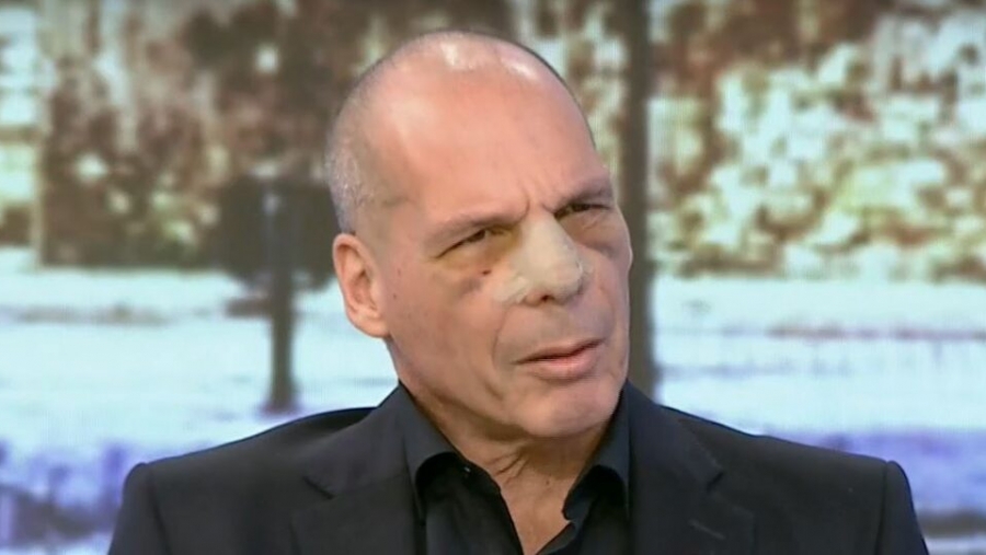 Η πρώτη εμφάνιση Βαρουφάκη μετά τον ξυλοδαρμό - Πως περιγράφει την επίθεση: Το πρόσωπο του δράστη είναι χαραγμένο στη μνήμη μου