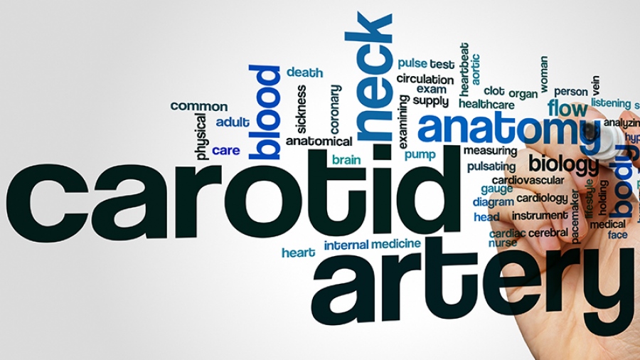 Στένωση καρωτιδικής αρτηρίας: Μία σιωπηλή απειλή
