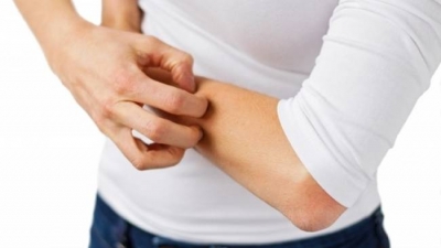 Έρπης ζωστήρας και ηλικία: Μια σχέση που «σοβαρεύει» με τα χρόνια