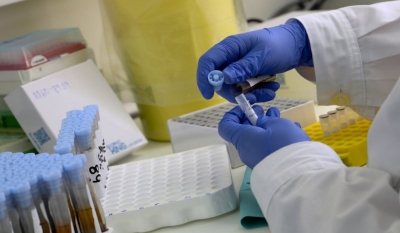 ΠΟΕΔΗΝ κατά Άδωνη: «Τα νοσοκομεία αγοράζουν PCR από ιδιώτες πολύ πιο φθηνά από το πλαφόν των 47 ευρώ»