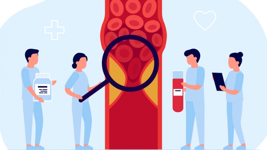 Αθηροσκλήρωση: Οι εξελίξεις στη φαρμακευτική αντιμετώπισή της