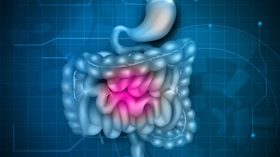 Ενδοσκοπική Κάψουλα: Η μοναδική μη επεμβατική μέθοδος απεικόνισης και διερεύνησης του λεπτού εντέρου