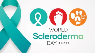 Σκληρόδερμα: Μορφές και θεραπεία