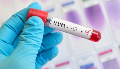 «Τέκνο» της ισπανικής γρίπης του 1918 η H1N1 – Πώς προκύπτει η απίστευτη σχέση τους, δεκαετίες μετά