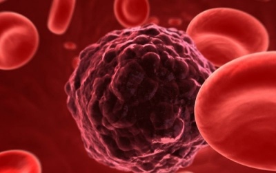 Ολοκληρωμένη θεραπεία για τον καρκίνο μέσα στο 2020 «υπόσχονται» επιστήμονες