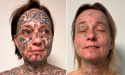 Ακραία κακοποίηση: Έκανε τατουάζ 250 φορές το όνομά του στο σώμα της κοπέλας του