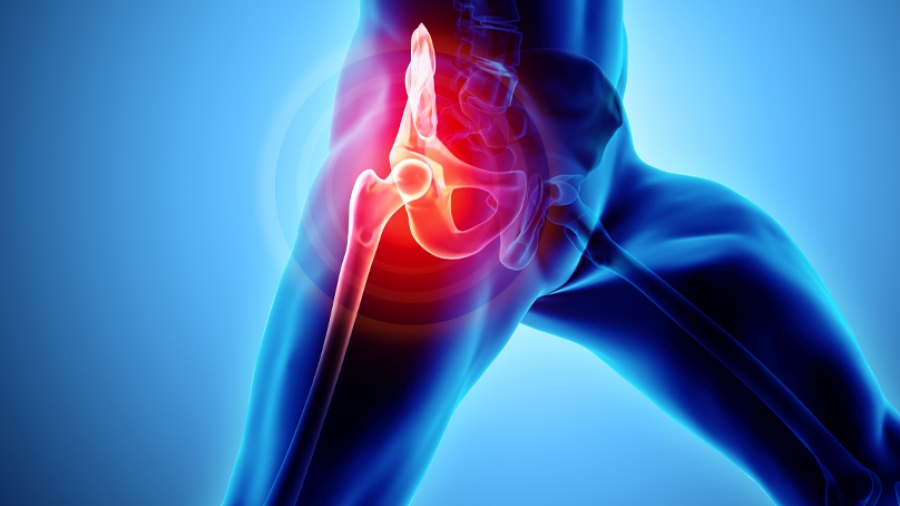 Πόνος στο ισχίο: Ένα συχνό, σύνηθες αλλά και ύπουλο σύμπτωμα