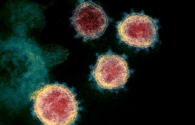 Εμφανίστηκε και νέα μετάλλαξη του Covid – Υπό έρευνα η αυξημένη μεταδοτικότητα και η αντίδρασή της στα εμβόλια