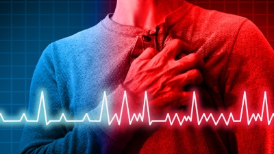 Κολπική μαρμαρυγή: Τι είναι και πώς αντιμετωπίζεται;