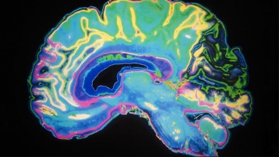 Yπάρχουν διαφορές ανάμεσα στον γυναικείο και τον ανδρικό εγκέφαλο; - Νέα έρευνα δίνει την απάντηση