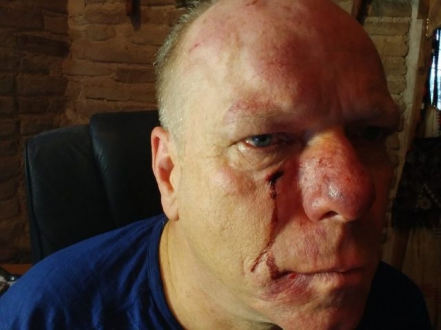 Θύμα ξυλοδαρμού έπεσε στο Σύνταγμα ο δημοσιογράφος της DW, Thomas Lacobi