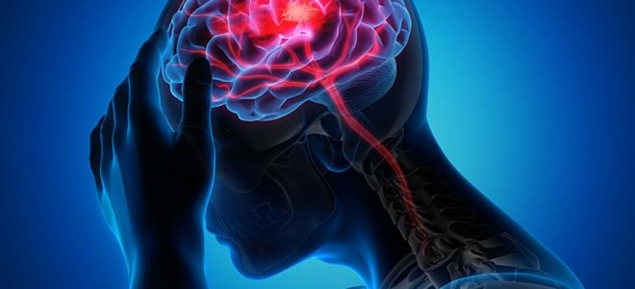 Ο ρόλος της μηχανικής θρομβεκτομής στην αντιμετώπιση του οξέος ισχαιμικού εγκεφαλικού επεισοδίου