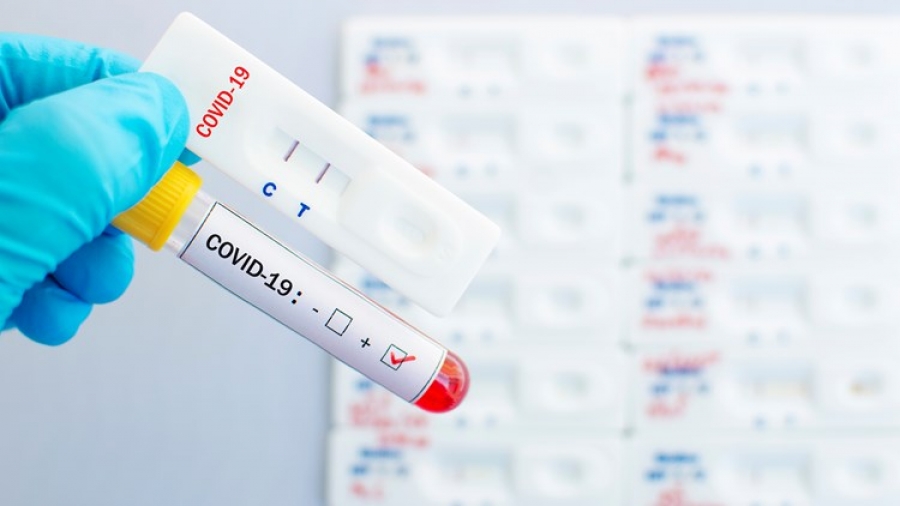 Μεγάλες ουρές και πολύωρη αναμονή για rapid test, PCR - ΕΟΔΥ: Δωρεάν rapid Κυριακή 2 Ιανουαρίου