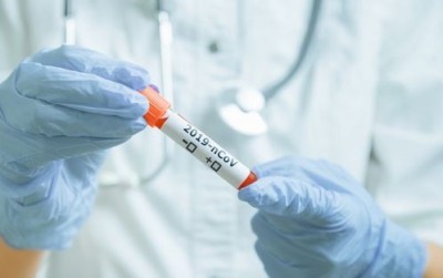 Κορωνοϊός: Θετικό το κρούσμα στον ΠΑΟΚ – Σε απομόνωση ο ποδοσφαιριστής, αρνητικοί στον ιό οι υπόλοιποι παίκτες