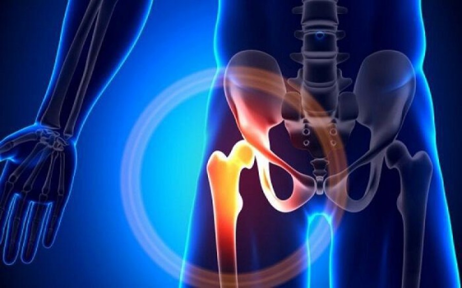 Πρωτόκολλα Fast –Track: Τι νέο φέρνουν στην Αρθροπλαστική ισχίου και γόνατος;