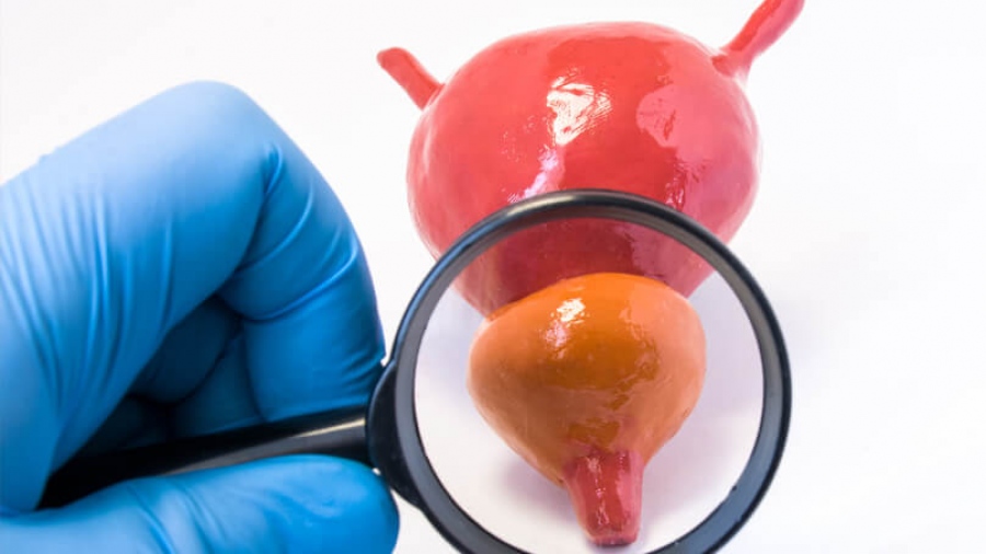 Καρκίνος Προστάτη: Fusion βιοψία και ρομποτική προστατεκτομή