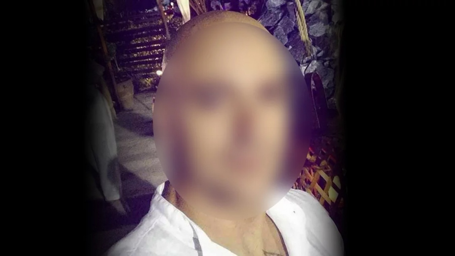 Έβγαλαν από την καταστολή τον αστυνομικό που τραυματίστηκε από τη φωτοβολίδα στου Ρέντη