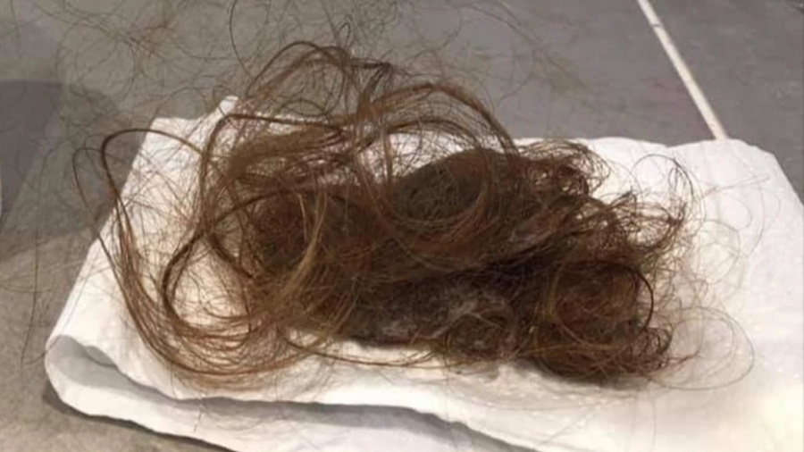 H long covid συγκλονίζει: «Έπεφταν τα μαλλιά μου, είχα αφόρητους πόνους, κρίσεις πανικού»