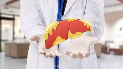 Λίπος στο συκώτι: Πως γίνεται η διάγνωση και ποια είναι η θεραπεία;