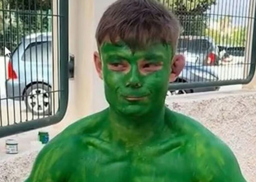 Μεταμφιέστηκε σε Hulk… και το μετάνιωσε πικρά - Οι έξι στρώσεις πράσινης μπογιάς που δεν έφευγαν με… τίποτε