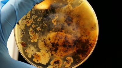Θανατηφόρα βακτήρια εντοπίστηκαν στον Μισισιπή - Προκαλούν τη σοβαρή λοίμωξη μελιοείδωση
