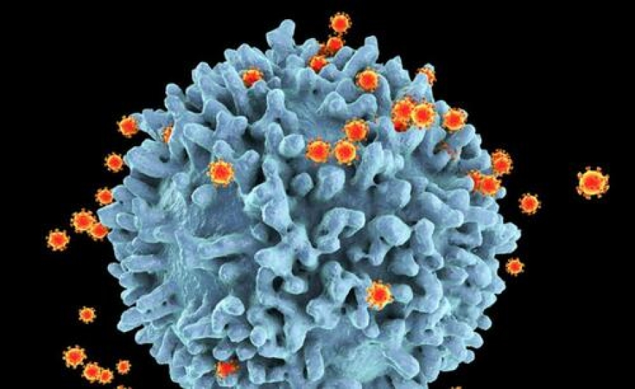 Συναγερμός στην Ολλανδία – Εντοπίστηκε εξαιρετικά μεταδοτική και επικίνδυνη παραλλαγή του ιού HIV που προκαλεί το AIDS
