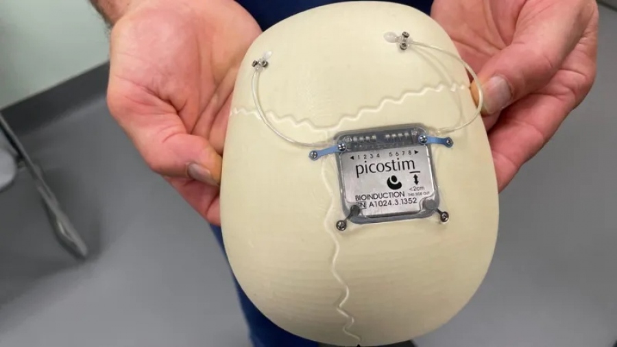 Εμφύτευμα σε εγκέφαλο 13χρονου με επιληψία – Παγκόσμια πρώτη