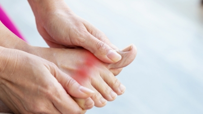Ουρική αρθρίτιδα: Συμπτώματα, διάγνωση και θεραπεία