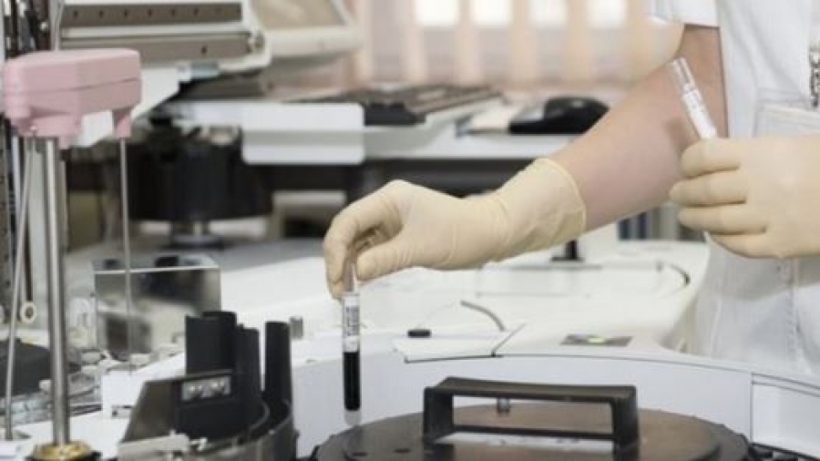 Σε κινητοποιήσεις απο 18-20/7 τα διαγνωστικά εργαστήρια, τα πολυιατρεία και οι κλινικοεργαστηριακοί γιατροί - Τι ζητούν