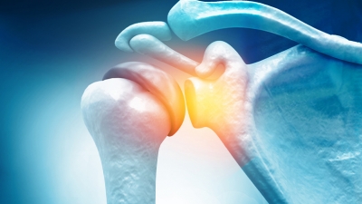 Αρθροσκόπηση: Η πιο σύγχρονη μέθοδος αντιμετώπισης ρήξης τενόντων του ώμου