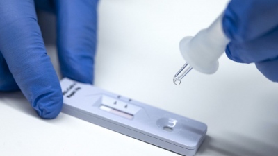 Το rapid test επιστρέφει - Τι ανακοίνωσε ο ΕΟΔΥ για τον ιό του Δυτικού Νείλου