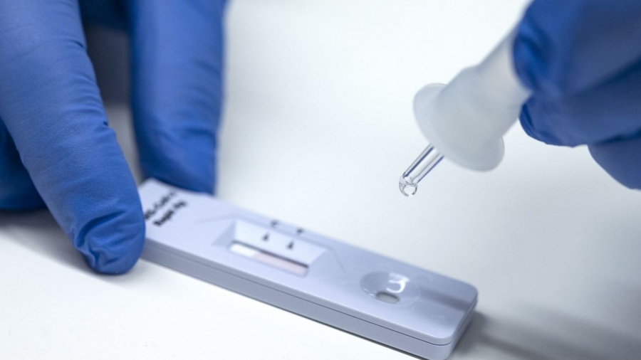 Το rapid test επιστρέφει - Τι ανακοίνωσε ο ΕΟΔΥ για τον ιό του Δυτικού Νείλου