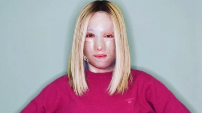 Πλεύρης για την υπόθεση Παλιοσπύρου: Θα αποζημιώνονται οι εγκαυματίες από εγκληματικές ενέργειες