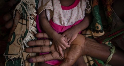 ΟΗΕ: Περισσότεροι από 400.000 άνθρωποι σε κατάσταση λιμού μόνο στην επαρχίαΤιγκράι της Αιθιοπίας