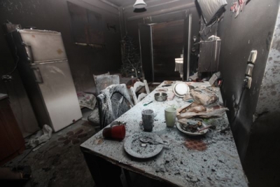Τραγωδία στον Κολωνό: Κατέληξε ο 5χρονος από τη φωτιά στο διαμέρισμα - Υπέκυψε μετά από 12 ημέρες μάχης