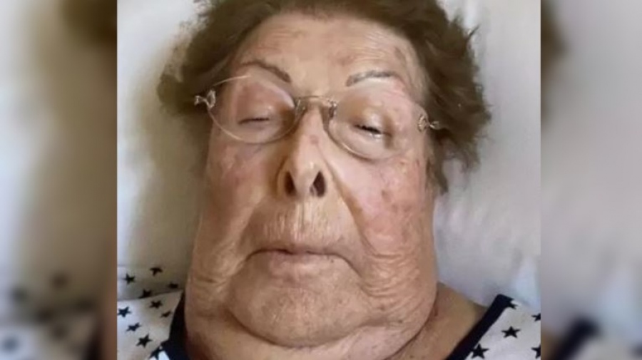 Αγνώριστη στο νοσοκομείο η Βέφα Αλεξιάδου