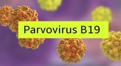 Ελληνική Εταιρεία Λοιμώξεων: Οι 7 ερωτήσεις και απαντήσεις για λοίμωξη από παρβοϊό Β19