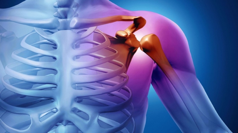 Ρήξη τενόντων του ώμου: Τι είναι και πώς αντιμετωπίζεται