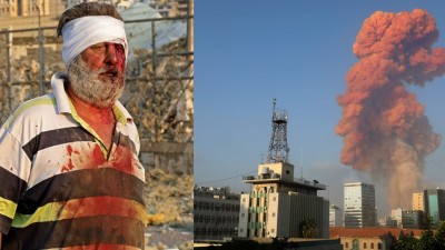 Λίβανος: Διαδοχικές εκρήξεις στη Βηρυτό από άγνωστη αιτία, τουλάχιστον δέκα νεκροί, εκατοντάδες τραυματίες