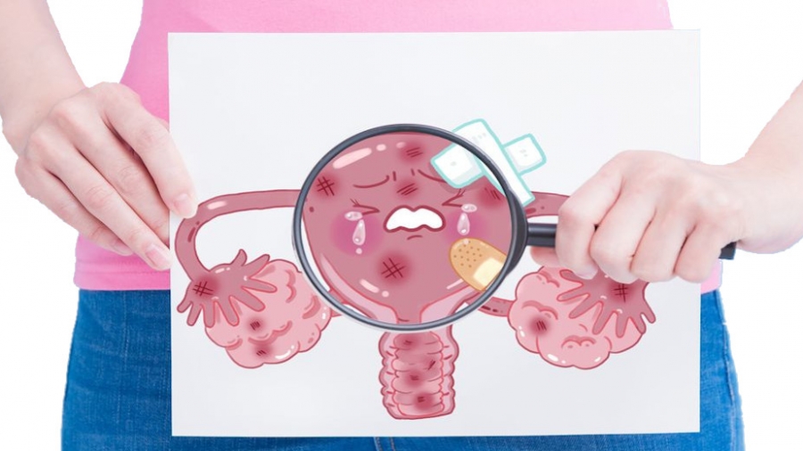 Καρκίνος ενδομητρίου - Προκλήσεις και νεότερες εξελίξεις