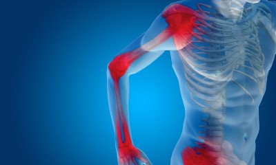 Οστεοπόρωση: Μια συχνή πάθηση των γυναικών