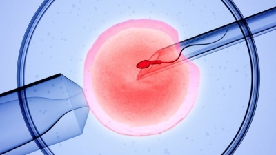 Εξωσωματική γονιμοποίηση: Φυσικός κύκλος ή κλασσική διέγερση ωοθηκών;