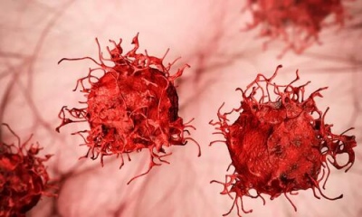 Ανησυχητική η άνοδος του πρώιμου καρκίνου στους νέους - Ποιες μορφές θερίζουν - Κώδωνας κινδύνου από επιστήμονες