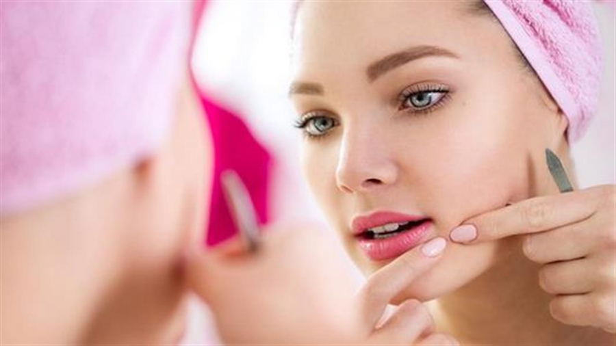 Ακμή: Mία νόσος, πολλοί μύθοι