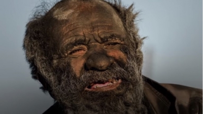 Ιράν: Πέθανε ο πιο βρώμικος άνθρωπος στον κόσμο σε ηλικία 94 ετών - Είχε να πλυθεί πάνω από 50 χρόνια