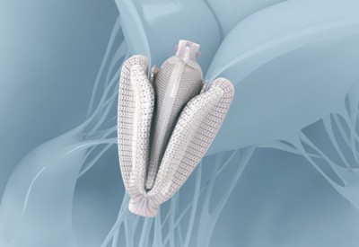 ΥΓΕΙΑ: Νέες θεραπευτικές δυνατότητες για τη θεραπεία ασθενών με πρόβλημα στην τριγλώχινα βαλβίδα της καρδιάς