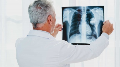 Παγκόσμια ημέρα ακτινολογίας - Η σύγχρονη Ιατρική Απεικόνιση έχει επεκταθεί και στην θεραπευτική αντιμετώπιση